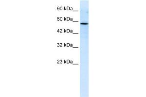 WB Suggested Anti-RIPX Antibody Titration:  0. (RUFY3 anticorps  (C-Term))