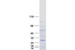 Validation with Western Blot