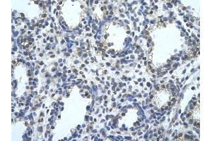 Rabbit Anti-BLZF1 Antibody       Paraffin Embedded Tissue:  Human alveolar cell   Cellular Data:  Epithelial cells of renal tubule  Antibody Concentration:   4. (BLZF1 anticorps  (C-Term))