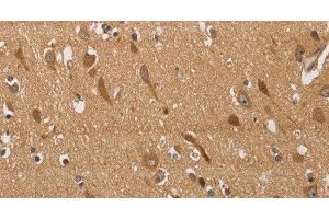 Immunohistochemistry of paraffin-embedded Human brain using KCNQ4 Polyclonal Antibody at dilution of 1:40