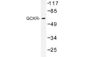 Image no. 1 for anti-Glucokinase (Hexokinase 4) Regulator (GCKR) antibody (ABIN272232) (GCKR anticorps)