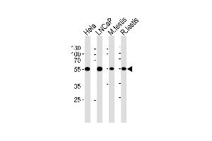 Western blot analysis of lysates from Hela, LNCaP cell line, mouse testis and rat testis tissue lysates(from left to right), using ULK3 Antibody (C-term) (ABIN6243328 and ABIN6577077). (ULK3 anticorps  (C-Term))