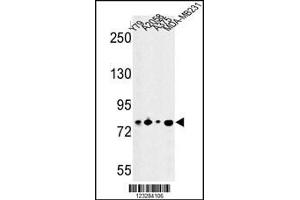 Western blot analysis of CSRP2BP Antibody in Y79, A2058, A375, MDA-MB231 cell line lysates (35ug/lane) (CSRP2BP anticorps  (AA 246-275))