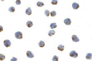 anti-Endoplasmic Reticulum To Nucleus Signaling 1 (ERN1) (C-Term) antibody