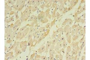 Immunohistochemistry of paraffin-embedded human heart tissue using ABIN7173155 at dilution of 1:100