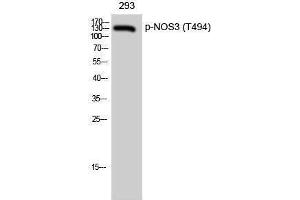 Western Blotting (WB) image for anti-Nitric Oxide Synthase 3 (Endothelial Cell) (NOS3) (pThr494) antibody (ABIN3182095) (ENOS anticorps  (pThr494))