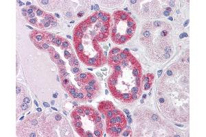 Anti-PARP3 antibody IHC of human kidney. (PARP3 anticorps  (AA 90-104))