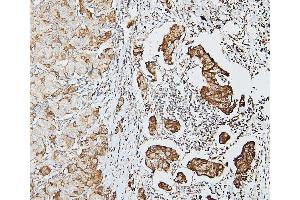 IHC analysis of DDR1 using anti-DDR1 antibody (ABIN7601407). (DDR1 anticorps  (AA 341-909))