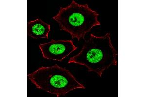 Fluorescent image of MCF-7 cells stained with ZN Antibody (Center) (ABIN1882027 and ABIN2843373). (Zinc Finger and SCAN Domain Containing 32 (ZSCAN32) (AA 159-187) anticorps)