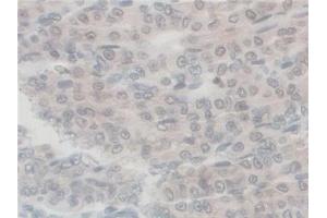 Detection of GFM1 in Mouse Stomach Tissue using Polyclonal Antibody to G-Elongation Factor, Mitochondrial 1 (GFM1)