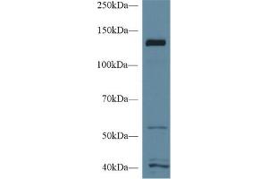 Detection of MGEA5 in Human MCF7 cell lysate using Polyclonal Antibody to Meningioma Expressed Antigen 5 (MGEA5)