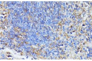 Immunohistochemistry of paraffin-embedded Mouse spleen using STK24 Polyclonal Antibody at dilution of 1:100 (40x lens). (STK24 anticorps)