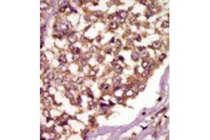 Image no. 2 for anti-BMX Non-Receptor Tyrosine Kinase (BMX) (Middle Region) antibody (ABIN359973) (BMX anticorps  (Middle Region))