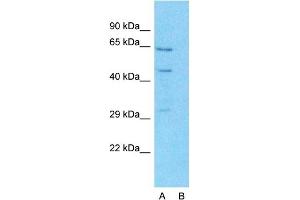 Host:  Rabbit  Target Name:  SLC27A2  Sample Type:  Hela  Lane A:  Primary Antibody  Lane B:  Primary Antibody + Blocking Peptide  Primary Antibody Concentration:  1ug/ml  Peptide Concentration:  5.