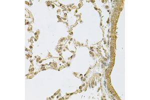 Immunohistochemistry of paraffin-embedded rat lung using PSMA5 Antibody (ABIN6292510) at dilution of 1:100 (40x lens). (PSMA5 anticorps)