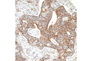 anti-Spectrin Beta, Non-Erythrocytic 1 (SPTBN1) (AA 2100-2150) antibody