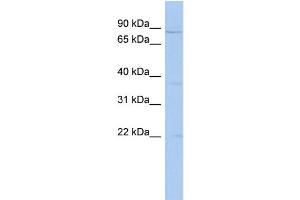 WB Suggested Anti-PCSK4 Antibody Titration: 0.