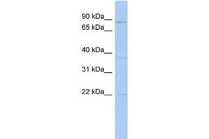 WB Suggested Anti-PCSK4 Antibody Titration: 0. (PCSK4 anticorps  (N-Term))