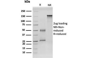 SDS-PAGE Analysis Purified RET-Monospecific Mouse Monoclonal Antibody (RET/2599). (Ret Proto-Oncogene anticorps  (AA 702-848))