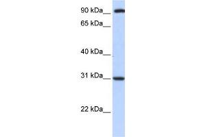 Human HeLa; WB Suggested Anti-ANKRA2 Antibody Titration: 0. (ANKRA2 anticorps  (C-Term))