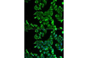 Immunofluorescence analysis of HeLa cell using STOM antibody. (Stomatin anticorps)