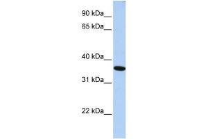 WB Suggested Anti-GTF2A1 Antibody Titration: 0. (GTF2A1 anticorps  (N-Term))