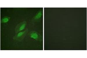 Immunofluorescence analysis of HeLa cells, using Akt (Ab-326) Antibody.