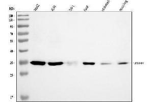 Western blot analysis of Annexin-4/ANXA4 using anti-Annexin-4/ANXA4 antibody (ABIN7599265).