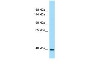 WB Suggested Anti-DRP2 Antibody Titration: 1. (DRP2 anticorps  (Middle Region))