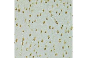 Immunohistochemistry of paraffin-embedded rat brain using RCC1 antibody (ABIN5973761) at dilution of 1/100 (40x lens). (RCC1 anticorps)