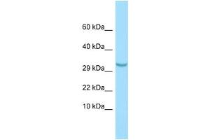 WB Suggested Anti-C1QTNF3 Antibody Titration: 1. (C1QTNF3 anticorps  (N-Term))
