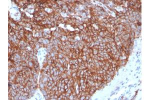 Formalin-fixed, paraffin-embedded human Tongue stained with GLUT-1 Recombinant Rabbit Monoclonal Antibody (GLUT1/3132R).