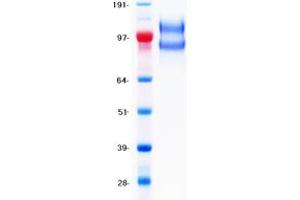 Validation with Western Blot