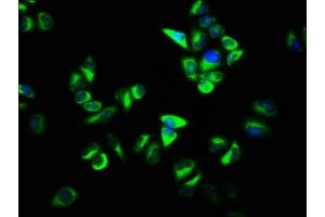 Immunofluorescence staining of Hela cells with ABIN7162395 at 1:133, counter-stained with DAPI. (OSBP anticorps  (AA 628-802))