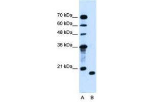 Image no. 1 for anti-Peptidyl-tRNA Hydrolase 2 (PTRH2) (AA 100-149) antibody (ABIN205058) (PTRH2 anticorps  (AA 100-149))