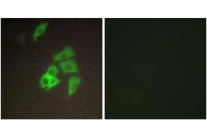 Immunofluorescence analysis of A549 cells, using ST14 Antibody. (ST14 anticorps  (AA 10-59))