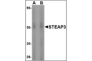 Western blot analysis of STEAP3 in rat liver tissue lysate with this product at (A) 1 and (B) 2 μg/ml. (STEAP3 anticorps  (N-Term))