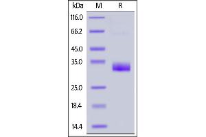 Biotinylated Human Angiopoietin-2, His,Avitag on  under reducing (R) condition.