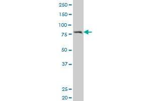 CTCF polyclonal antibody (A01), Lot # 050727JC01 Western Blot analysis of CTCF expression in HL-60 .