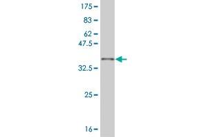 Western Blot detection against Immunogen (32. (SIX3 anticorps  (AA 273-332))