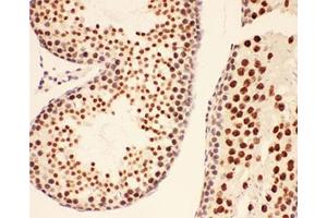 IHC-P testing of rat testis tissue (BRCA1 anticorps  (AA 1661-1863))