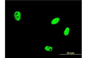 Immunofluorescence of monoclonal antibody to EHMT1 on HeLa cell. (EHMT1 anticorps  (AA 1-100))