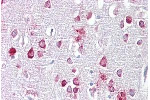 Anti-PPME1 antibody IHC staining of human brain, cortex.