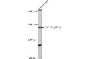 Western blot analysis of extracts of Mouse brain, using SUPT16H (SPT16) antibody (ABIN7267097) at 1:1000 dilution. (SUPT16H anticorps)
