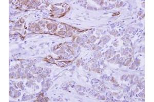 anti-WD Repeat Domain 49 (WDR49) (AA 343-666) antibody