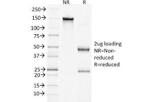 SDS-PAGE Analysis of Purified, BSA-Free Beta Catenin Antibody (clone 15B8).
