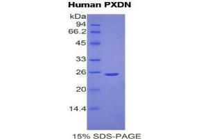 SDS-PAGE analysis of Human Peroxidasin Homolog Protein. (Peroxidasin Protéine)