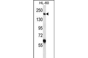 MYOM1 Antibody (Center) (ABIN657367 and ABIN2846414) western blot analysis in HL-60 cell line lysates (35 μg/lane). (Myomesin 1 anticorps  (AA 904-933))
