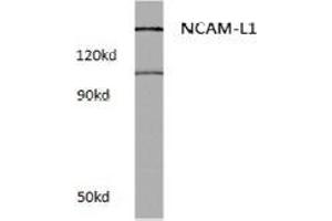 Western blot (WB) analysis of CD171 / L1CAM Antibody at 1/500 dilution in extracts from Raw264. (L1CAM anticorps)