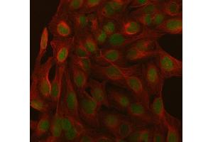 IF analysis of SAGE1 using anti-SAGE1 antibody (ABIN7602679) and anti-Beta Tubulin antibody (ABIN7602743). (SAGE1 anticorps  (AA 94-633))